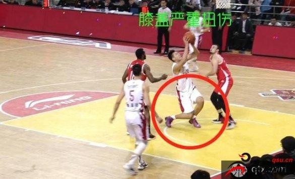 吉林男篮球员李安因伤导致膝盖变形