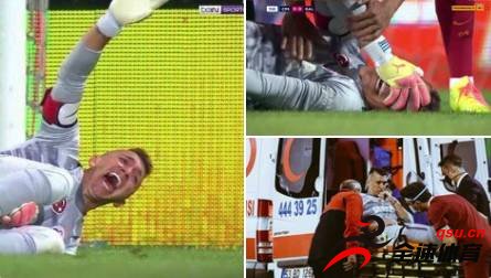 费尔南多-穆斯莱拉比赛中遭受到了腿骨骨折的严重伤病